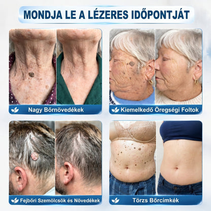 ✅👨‍🦳𝐇𝐢𝐯𝐚𝐭𝐚𝐥𝐨𝐬 𝐦á𝐫𝐤𝐚𝐛𝐨𝐥𝐭  𝐇𝐞𝐚𝐥𝐫𝐢𝐳𝐞®   𝟕 𝐍𝐚𝐩𝐨𝐬 𝐁ő𝐫𝐤𝐢𝐧ö𝐯é𝐬- é𝐬 𝐅𝐨𝐥𝐭𝐫𝐚𝐝í𝐫(Fájdalommentes, nyommentes roll-on)
