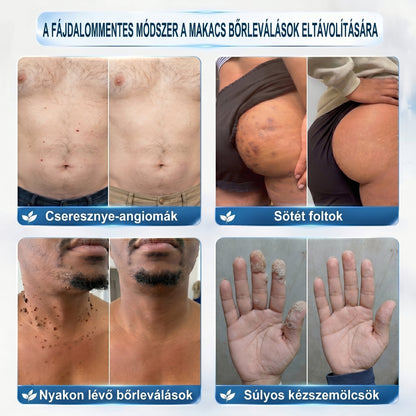 ✅👨‍🦳𝐇𝐢𝐯𝐚𝐭𝐚𝐥𝐨𝐬 𝐦á𝐫𝐤𝐚𝐛𝐨𝐥𝐭  𝐇𝐞𝐚𝐥𝐫𝐢𝐳𝐞®   𝟕 𝐍𝐚𝐩𝐨𝐬 𝐁ő𝐫𝐤𝐢𝐧ö𝐯é𝐬- é𝐬 𝐅𝐨𝐥𝐭𝐫𝐚𝐝í𝐫(Fájdalommentes, nyommentes roll-on)