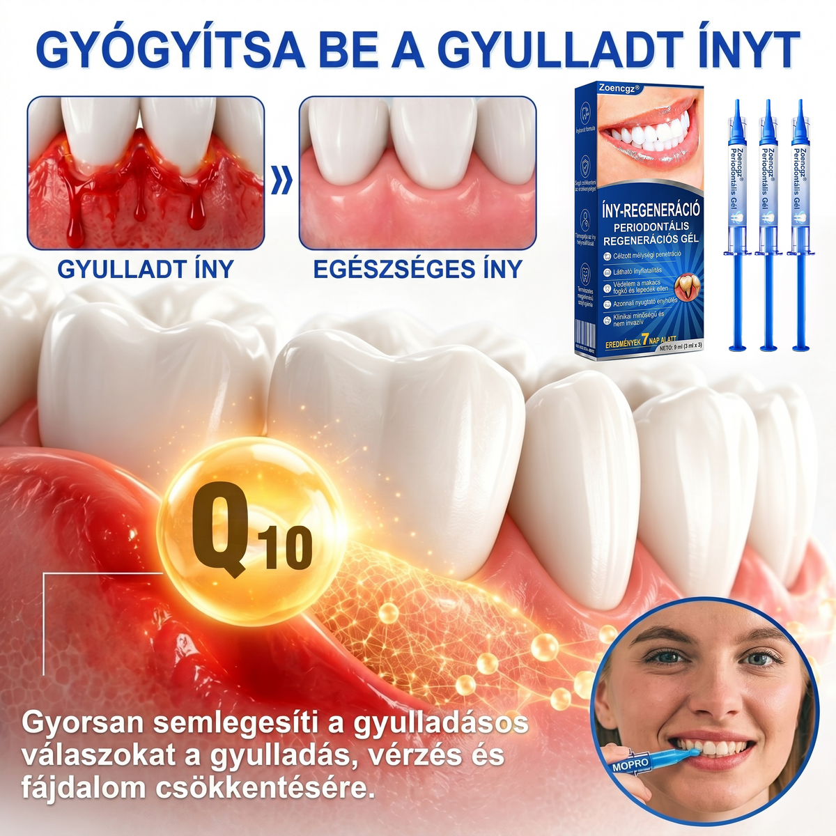 Zoencgz® 👅🍹 Antibakteriális ínyregeneráló gél | Látható eredmények már 7 nap alatt
