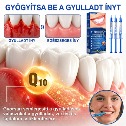 Zoencgz® 👅🍹 Antibakteriális ínyregeneráló gél | Látható eredmények már 7 nap alatt
