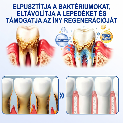 Zoencgz® 👅🍹 Antibakteriális ínyregeneráló gél | Látható eredmények már 7 nap alatt