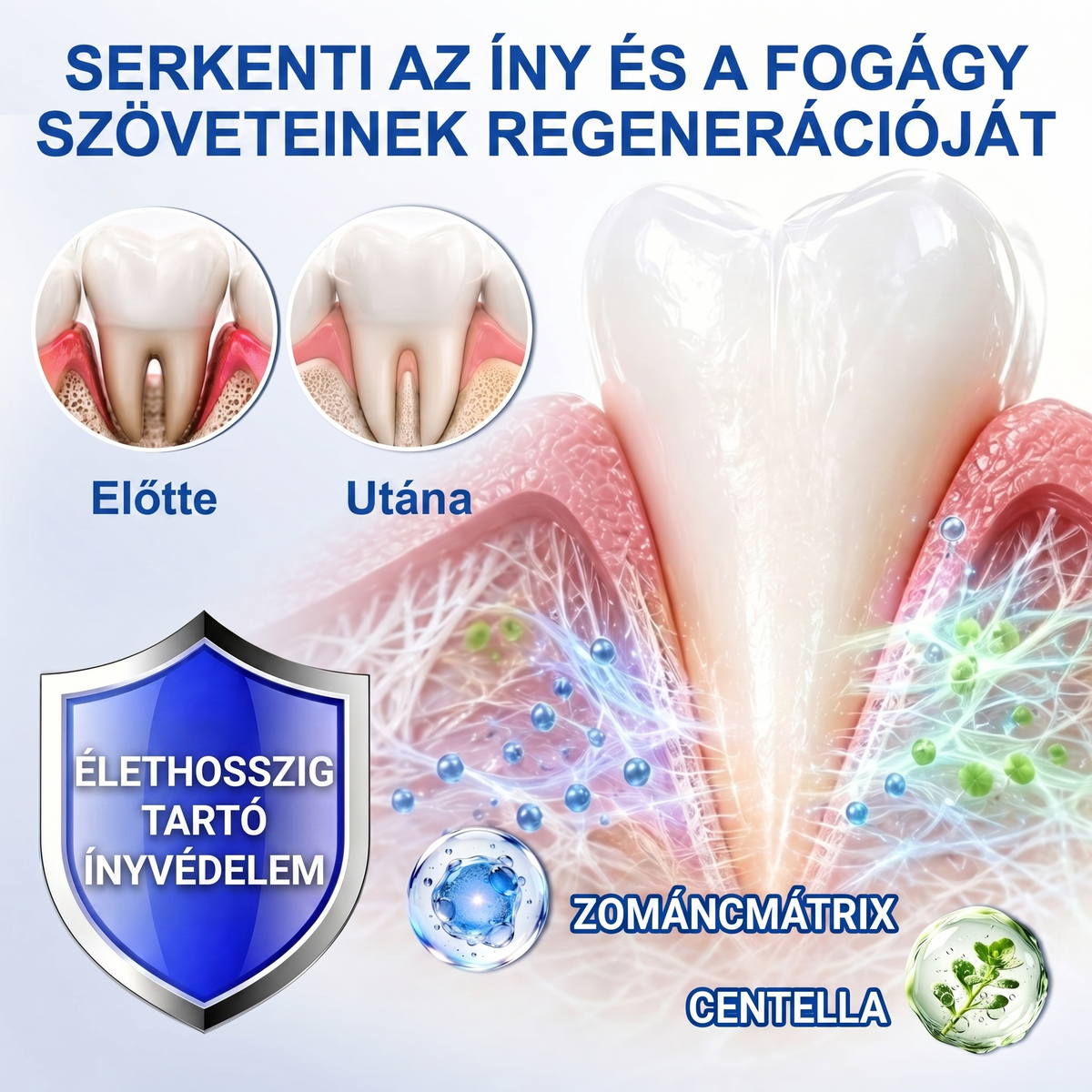 Zoencgz® 👅🍹 Antibakteriális ínyregeneráló gél | Látható eredmények már 7 nap alatt
