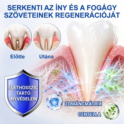 Zoencgz® 👅🍹 Antibakteriális ínyregeneráló gél | Látható eredmények már 7 nap alatt