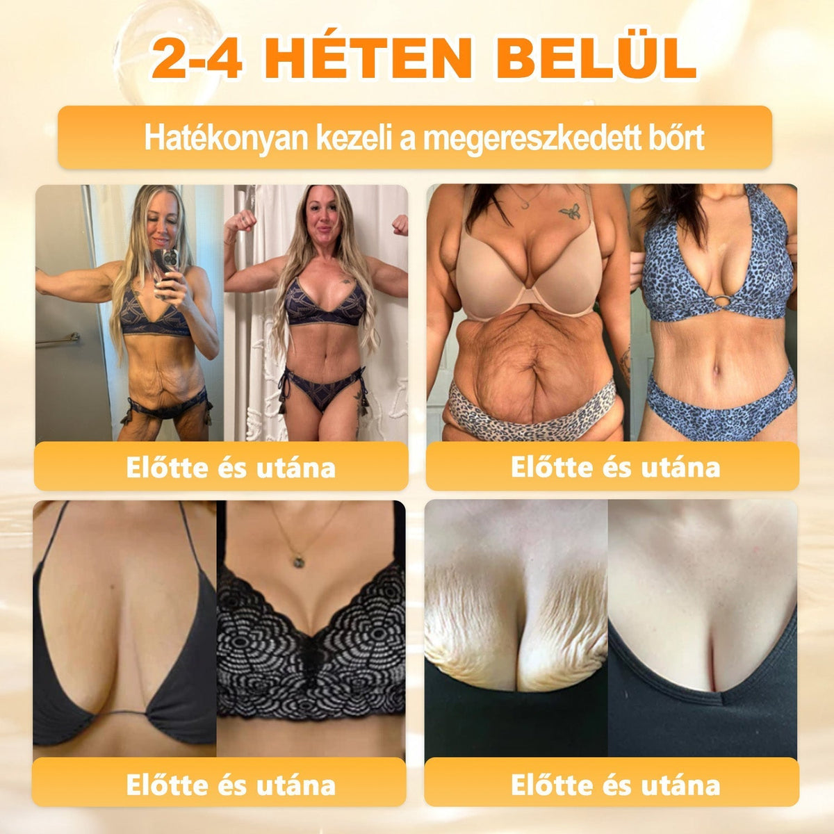 🐝🫎 𝐇𝐞𝐚𝐥𝐫𝐢𝐳𝐞® Méhméreg Komplex Arckrém – A természetes bőrápolás új generációja hidratáltabb, simább és ragyogóbb bőrért 🌿✨