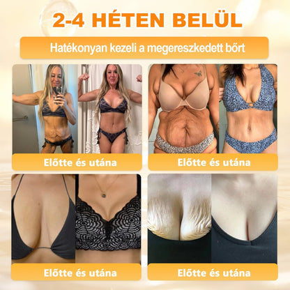 🐝🫎 𝐇𝐞𝐚𝐥𝐫𝐢𝐳𝐞® Méhméreg Komplex Arckrém – A természetes bőrápolás új generációja hidratáltabb, simább és ragyogóbb bőrért 🌿✨