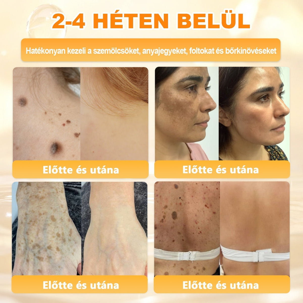 🐝🫎 𝐇𝐞𝐚𝐥𝐫𝐢𝐳𝐞® Méhméreg Komplex Arckrém – A természetes bőrápolás új generációja hidratáltabb, simább és ragyogóbb bőrért 🌿✨
