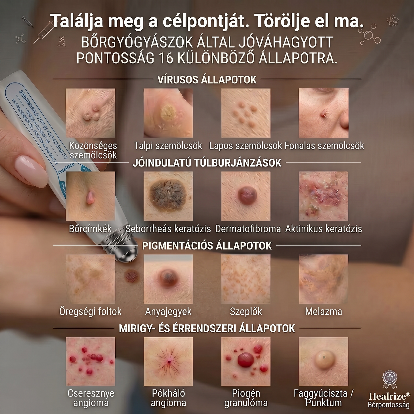 ✅👨‍🦳𝐇𝐢𝐯𝐚𝐭𝐚𝐥𝐨𝐬 𝐦á𝐫𝐤𝐚𝐛𝐨𝐥𝐭  𝐇𝐞𝐚𝐥𝐫𝐢𝐳𝐞®   𝟕 𝐍𝐚𝐩𝐨𝐬 𝐁ő𝐫𝐤𝐢𝐧ö𝐯é𝐬- é𝐬 𝐅𝐨𝐥𝐭𝐫𝐚𝐝í𝐫(Fájdalommentes, nyommentes roll-on)