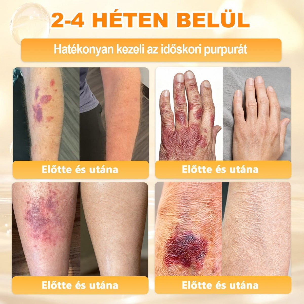 🐝🫎 𝐇𝐞𝐚𝐥𝐫𝐢𝐳𝐞® Méhméreg Komplex Arckrém – A természetes bőrápolás új generációja hidratáltabb, simább és ragyogóbb bőrért 🌿✨