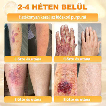 🐝🫎 𝐇𝐞𝐚𝐥𝐫𝐢𝐳𝐞® Méhméreg Komplex Arckrém – A természetes bőrápolás új generációja hidratáltabb, simább és ragyogóbb bőrért 🌿✨