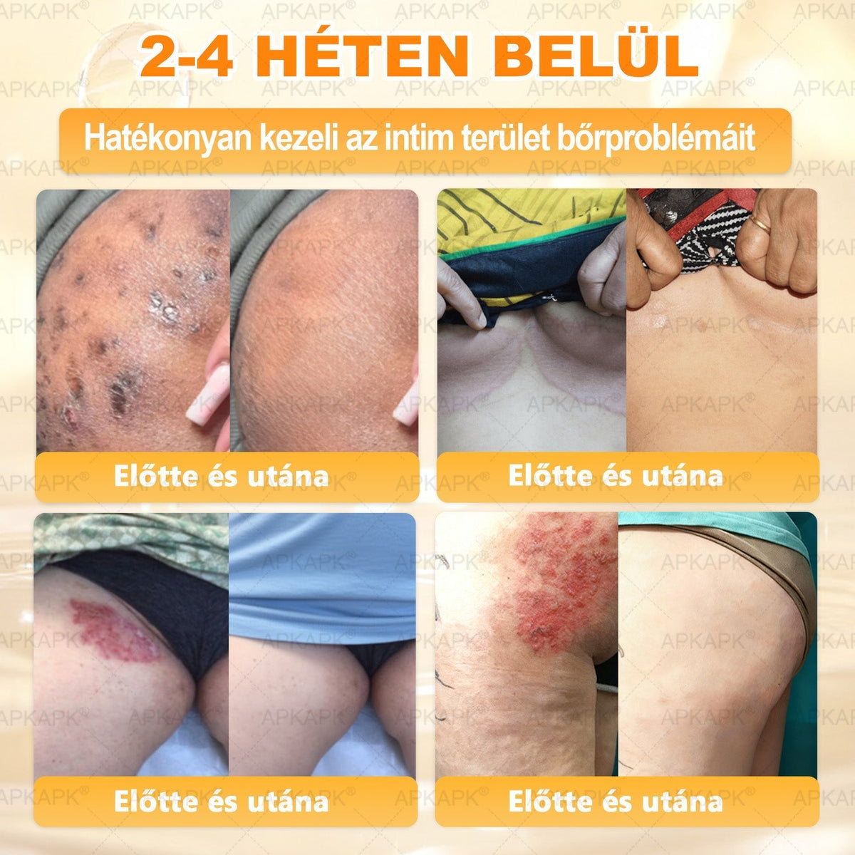 🐝🫎 𝐇𝐞𝐚𝐥𝐫𝐢𝐳𝐞® Méhméreg Komplex Arckrém – A természetes bőrápolás új generációja hidratáltabb, simább és ragyogóbb bőrért 🌿✨