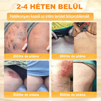 🐝🫎 𝐇𝐞𝐚𝐥𝐫𝐢𝐳𝐞® Méhméreg Komplex Arckrém – A természetes bőrápolás új generációja hidratáltabb, simább és ragyogóbb bőrért 🌿✨