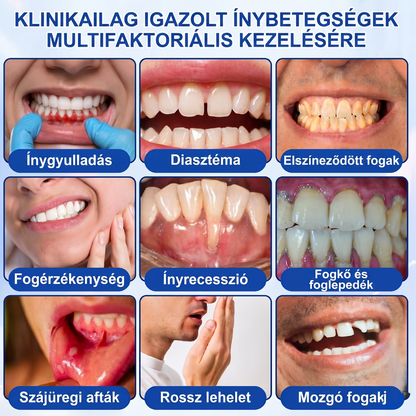 Zoencgz® 👅🍹 Antibakteriális ínyregeneráló gél | Látható eredmények már 7 nap alatt