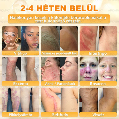 🐝🫎 𝐇𝐞𝐚𝐥𝐫𝐢𝐳𝐞® Méhméreg Komplex Arckrém – A természetes bőrápolás új generációja hidratáltabb, simább és ragyogóbb bőrért 🌿✨