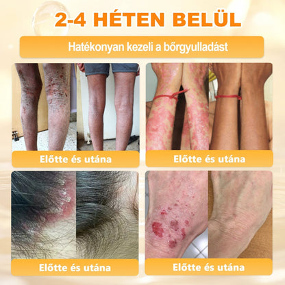 🐝🫎 𝐇𝐞𝐚𝐥𝐫𝐢𝐳𝐞® Méhméreg Komplex Arckrém – A természetes bőrápolás új generációja hidratáltabb, simább és ragyogóbb bőrért 🌿✨