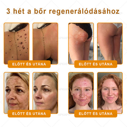 🐝🫎 𝐇𝐞𝐚𝐥𝐫𝐢𝐳𝐞® Méhméreg Komplex Arckrém – A természetes bőrápolás új generációja hidratáltabb, simább és ragyogóbb bőrért 🌿✨