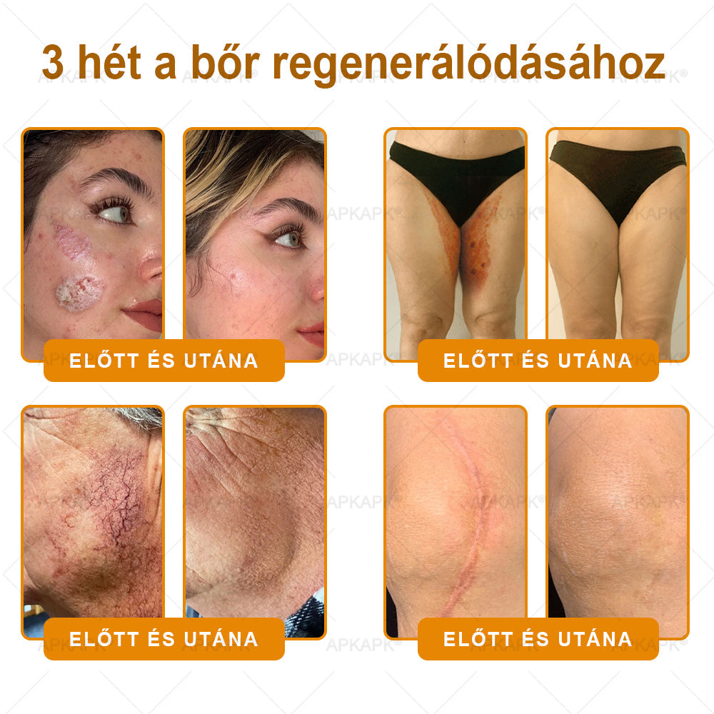 🐝🫎 𝐇𝐞𝐚𝐥𝐫𝐢𝐳𝐞® Méhméreg Komplex Arckrém – A természetes bőrápolás új generációja hidratáltabb, simább és ragyogóbb bőrért 🌿✨